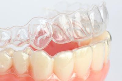 image of invisalign braces in wilmington ma